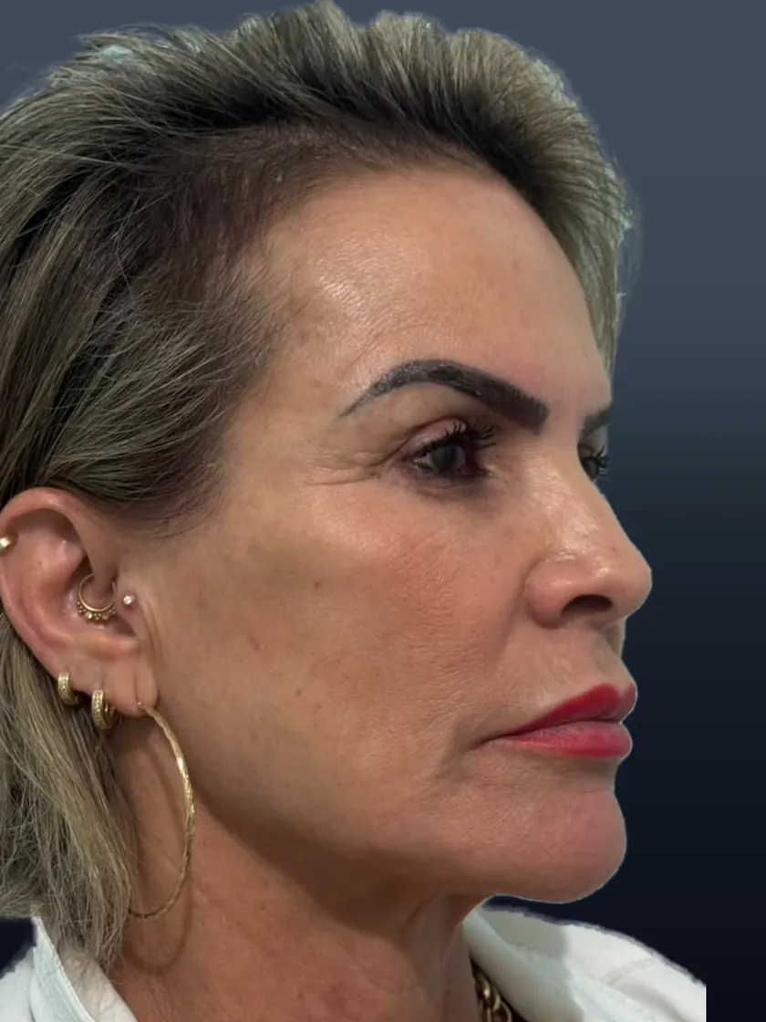 Registro da paciente na fase 3 do tratamento