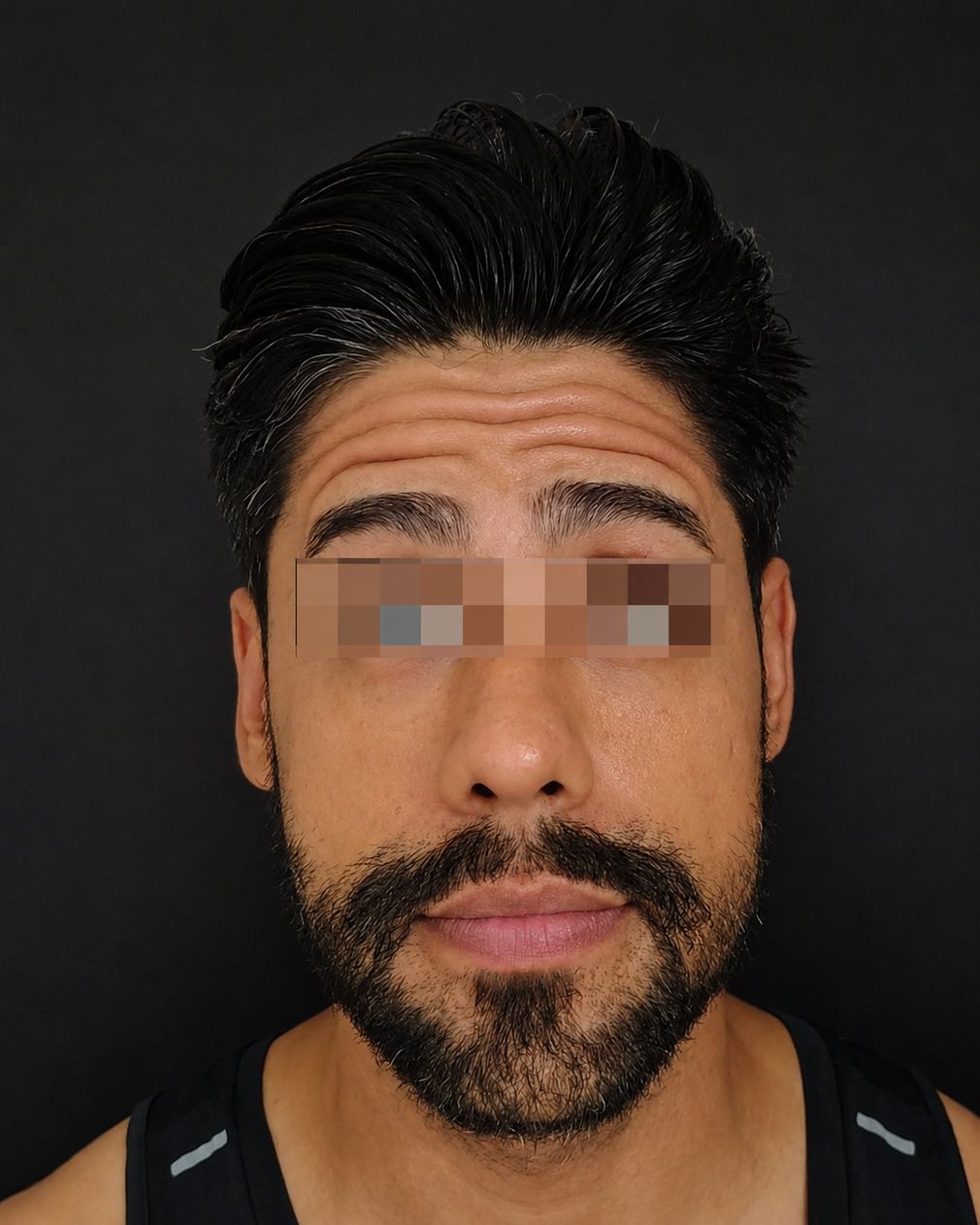 Antes do caso facial masculino, vista frontal